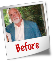 Larry B before photo